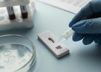 ILUSTRASI: Bisnis tes Polymerase Chain Reaction (PCR). (ISTIMEWA/LINGKARJATENG.ID)