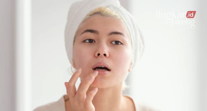 Anda Wajib Tahu, Inilah 5 Tips Ampuh Atasi Bibir Kering saat Puasa 25 ILUSTRASI: Bibir kering dan pecah-pecah. Sumber Gambar (Freepik @freepik/Lingkarjateng.id)
