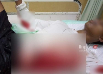 MENGENASKAN: Kondisi korban AF (19) mengalami luka di bagian perut akibat sayatan senjata tajam akibat dikeroyok orang tidak dikenal di Jembatan Kali Londo. (Istimewa/Lingkarjateng.id)