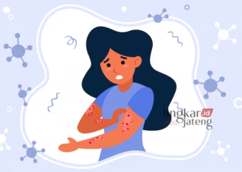 ILUSTRASI: Seseorang yang mengalami penyakit cacar air. (pch.vector from Freepik/Lingkarjateng.id)