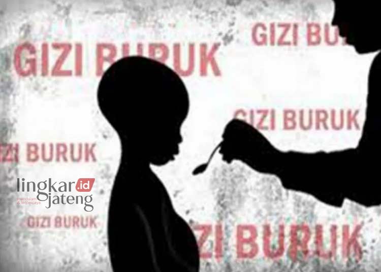 Penyebab Gizi Buruk pada Anak, DKK Kudus Sebut karena Pola Asuh Salah dan Anemia 25 ILUSTRASI: Balita yang mengalami gizi buruk. (Antaranews/Lingkarjateng.id)