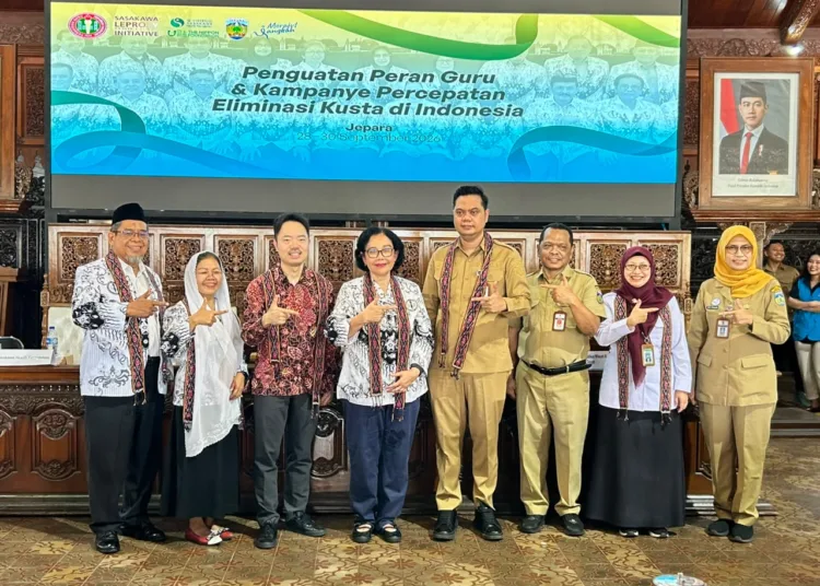 Bupati Witiarso dalam acara Workshop Penghapusan Stigma Kusta, Penguatan Peran Guru dan Kampanye Percepatan Eliminasi Kusta di Indonesia, di Pendapa RA Kartini Jepara, Senin kemarin. Foto :Dok.Pemkab Jepara for lingkar